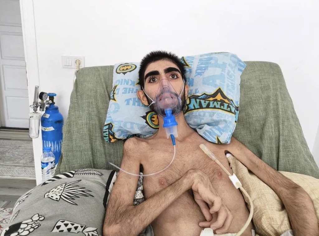 18 Yaşındaki Burak Tedavi İçin Destek Bekliyor