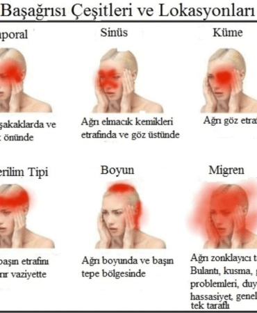 Baş Ağrısı: Ani Durumların Tehlikeleri ve Müdahaleler