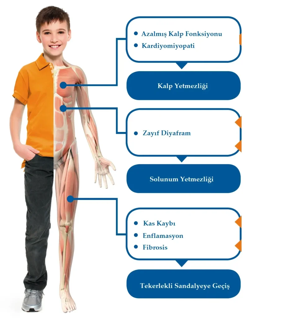 Duchenne Musküler Distrofi: Destek Olun Kermesi