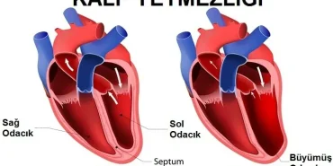 Kalp Yetmezliği Tedavisi 10 Aylık Bebek Ankaraya Sevk Edildi