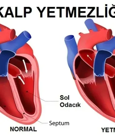 Kalp Yetmezliği Tedavisi 10 Aylık Bebek Ankaraya Sevk Edildi Patnos Haberleri Ağrı Patnos Son Dakika Haberleri Kalp Yetmezliği Tedavisi 10 Aylık Bebek Ankaraya Sevk Edildi