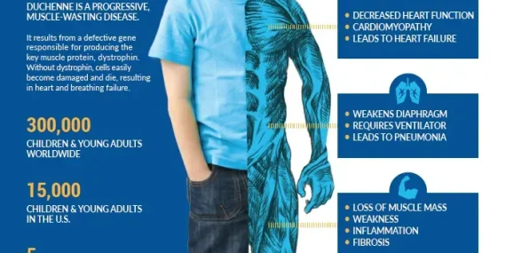 Duchenne Musküler Distrofi