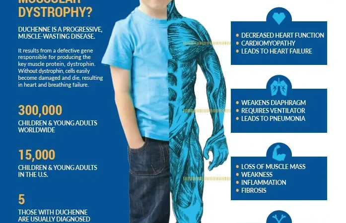 Duchenne Musküler Distrofi