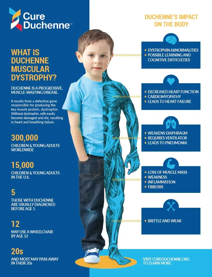 Duchenne Musküler Distrofi